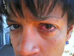 redeye.jpg
