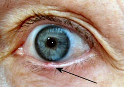 eyestyepicture