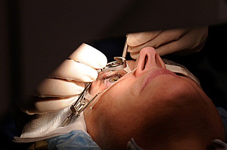 keepingeyeopenlaser surgery